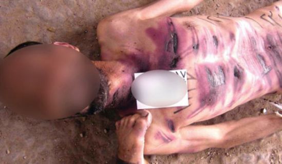 تحقيق جديد لمنظمة حقوق الإنسان  يثبت حقيقة التعذيب الجماعي والتجويع والموت في سجون بشار